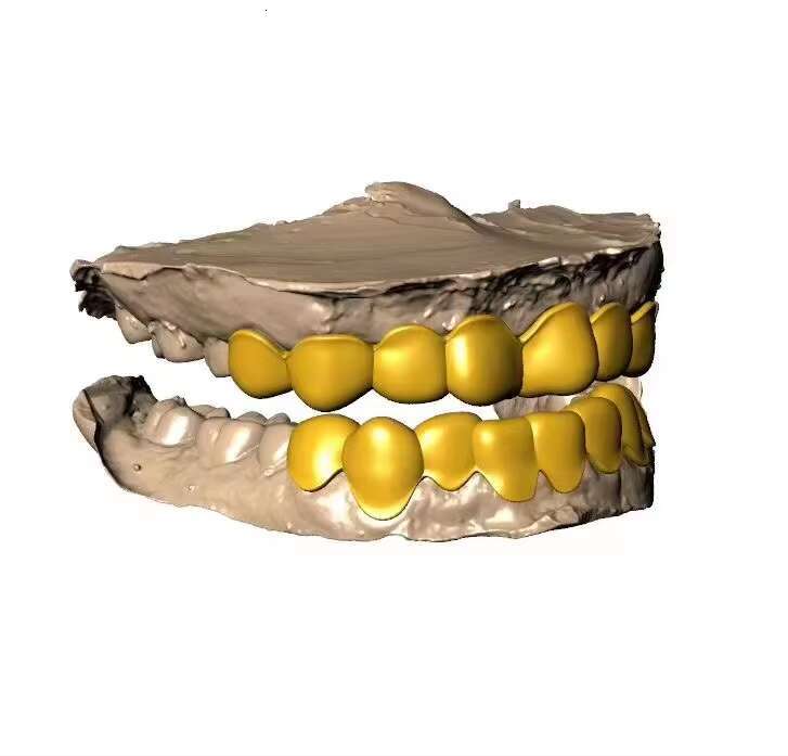 Custom 925 Sterling Silver Moissanite Diamond Grillz VVS1 White Gold Real Handmade Gold Plated Iced Out Fine Hip Hop Jewelry