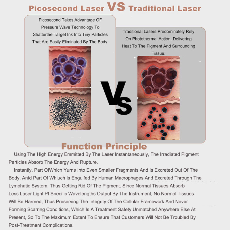 Portable Picolaser Nd Yag Pico Second Picosecond Laser Remove Freckles Q Switched Laser For Tatoo Removal Black Doll Treatment Skin Rejuvenation Machi