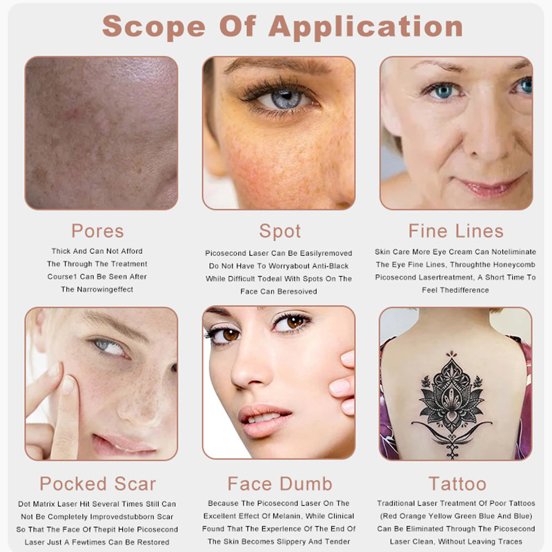 Portable Picolaser Nd Yag Pico Second Picosecond Laser Remove Freckles Q Switched Laser For Tatoo Removal Black Doll Treatment Skin Rejuvenation Machi