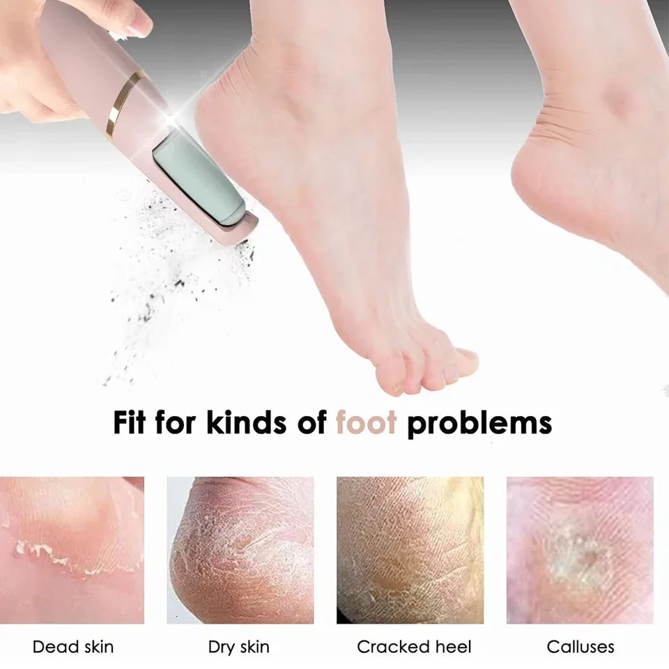 Electric Foot Grinding Skin Hard Rupture Skin Trimmer Dead Skin Foot Pedicure Rechargeable Foot Care Tool Feet Callus Remover 250624