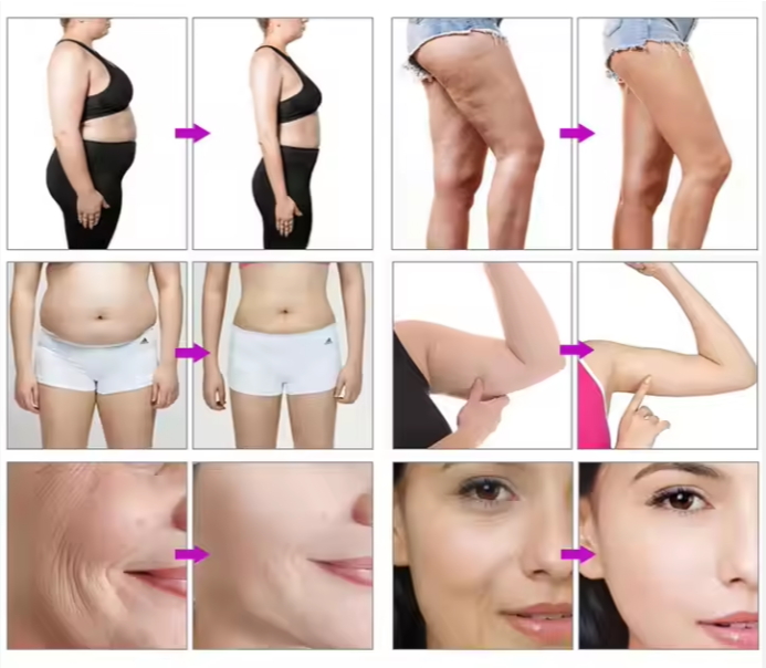 Professional 6 in 1 40K Cavitation Ultrasonic S Shape Cavitation 30K Vacuum Rf Body Slimming Machine for Beauty Salons