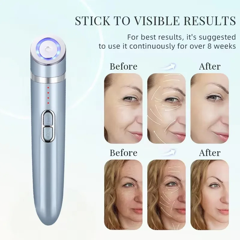 EMS Eye Massager Antiaging Beauty Instrument Eye Care Massage Tool Wrinkle Removal Face Lifting Beauty Device Home Use 251010