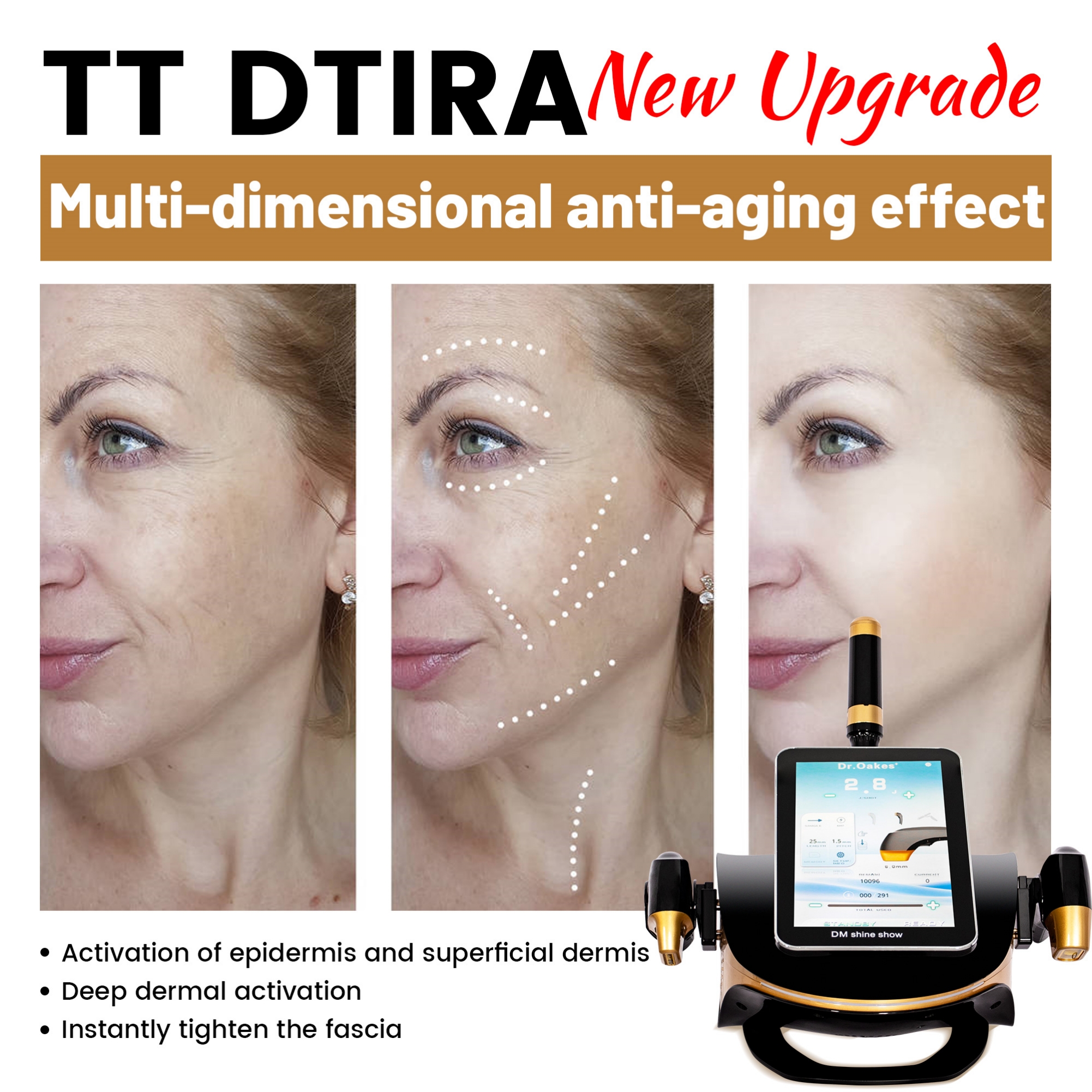 TTHifu Beauty Device With Ultrasounc Technology - Facial Lifting Machine - Skin Rejuvenation - Stimulates Collagen - Safe & Effective Beauty Salon Exc