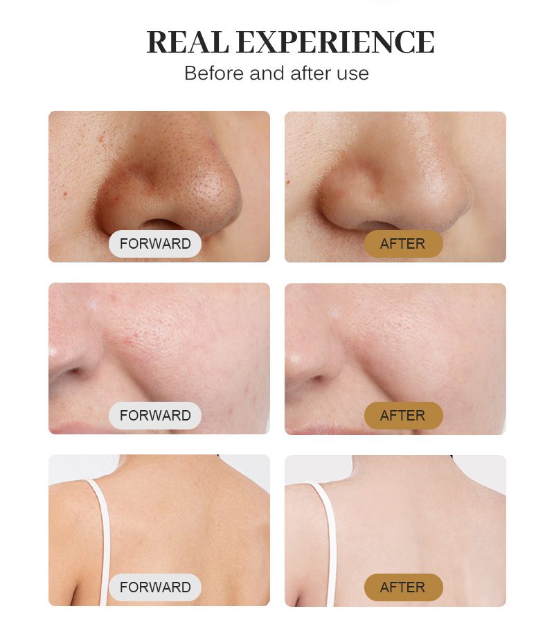Professional Facial Lift Cleaning Water-based Exfoliation Skin Care Skin Grinding Oxygen Machine Beauty Equipment Salon