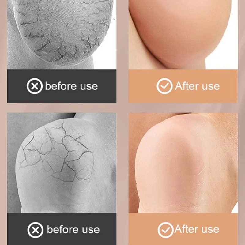 Crack Resistant Heel Pad Foot Sole Protection Cover Preventing Plantar Fasciitis Half Shoe Pad Achilles Tendon Heel Protector 251013