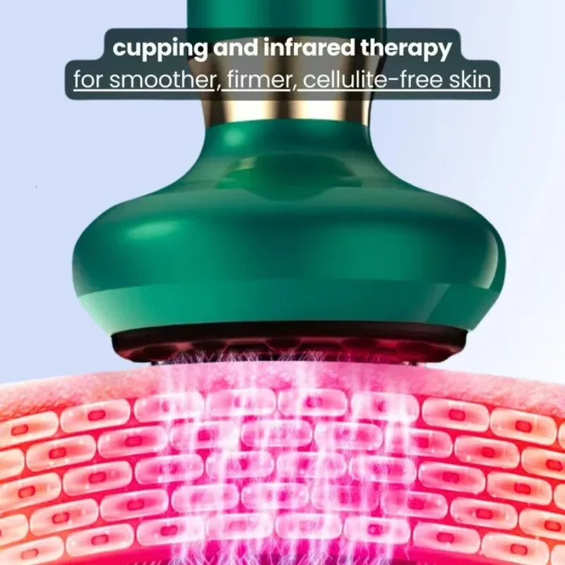 Emeka 5in1 Anti Cellulite Massager Infrared Heat Mechanical Stimulation Cupping for Home Treatment Scraping Apparatus 251015