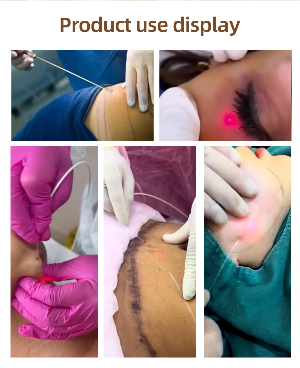 Beauty Equipment 1470nm Diode Laser Lipolysis Machine For Salon Spa Slimming Shaping Fat Reduction Skin Tightening Device