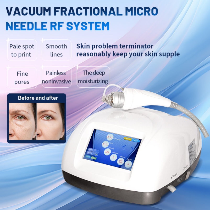 Facial Radio Frequency Vacuum Skin Tightening Rf Microneedle Lines Reducing Wrinkle Removal Professional Equipment