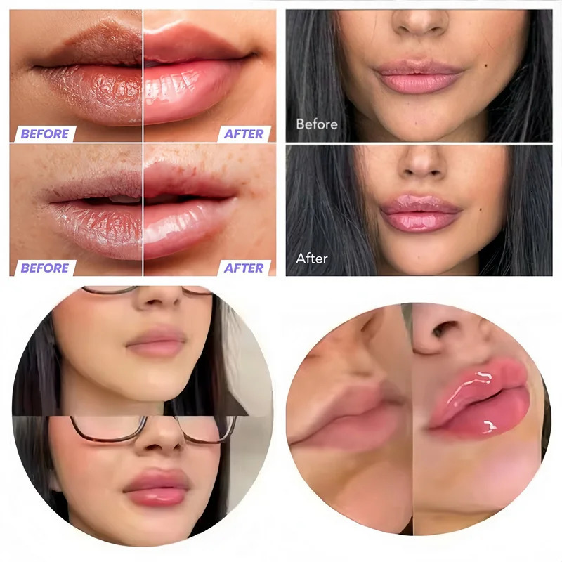 Glow Tulip Lip Plumper Spicule Plumping Lip S Extreme Lip Plumper Gloss Extreme Volume Serum Oil Sexy Beauty Makeup Korean 251022