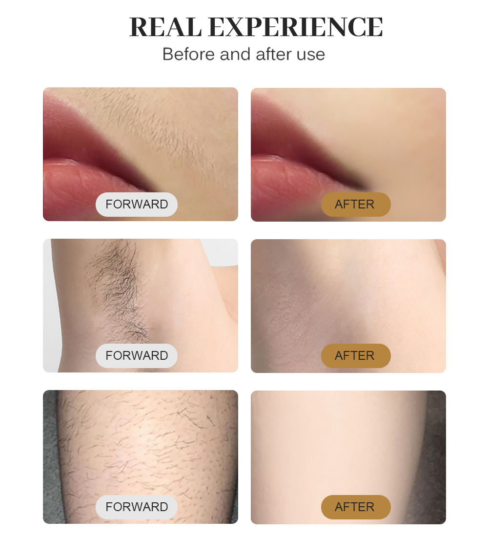 Professional 808nm Diode Laser Hair Removal Device With Cooling Technology Ice Tip Painless Treatment For Women and Men Body Face