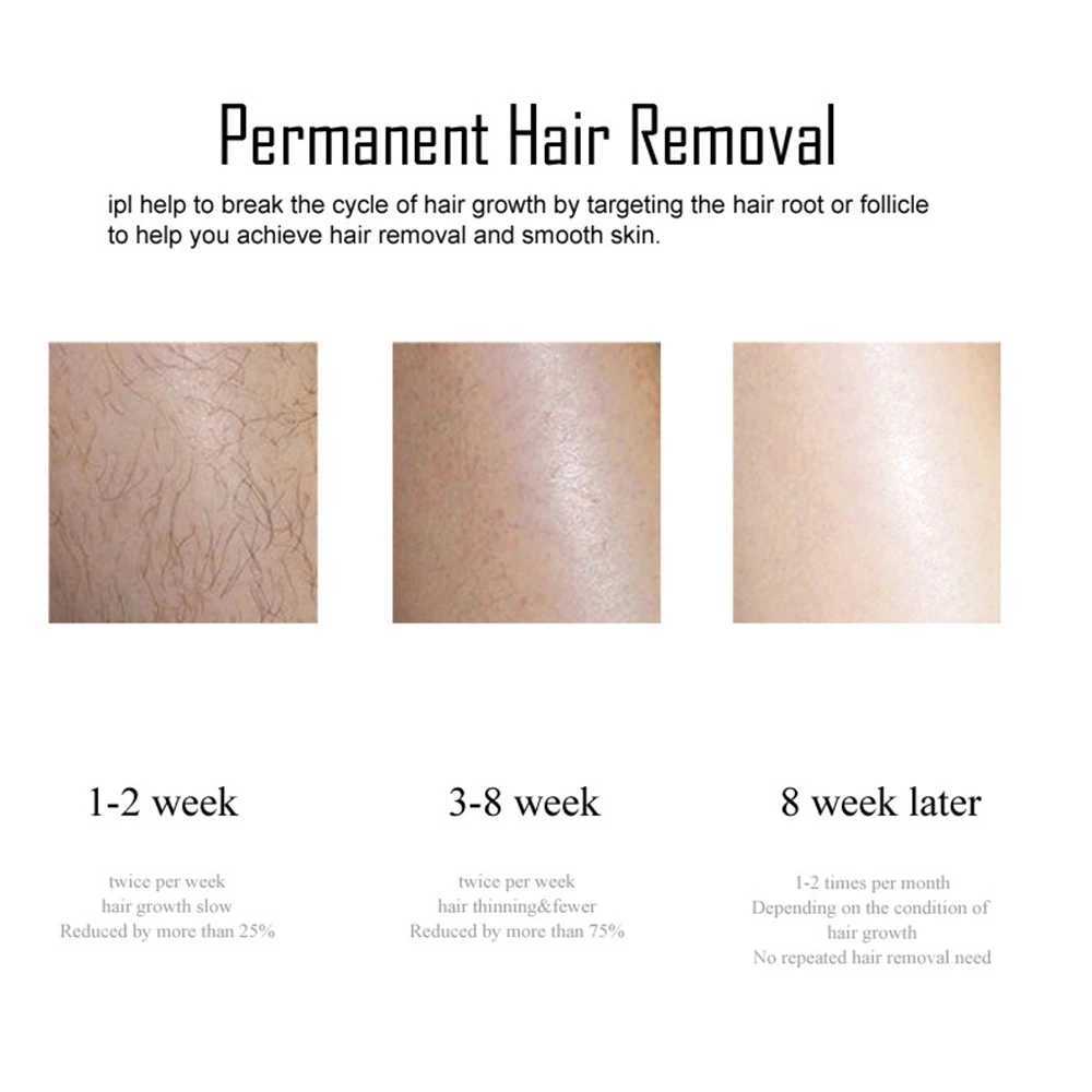 3 in 1 Ice Laser Epilator 999999 Flashes IPL Hair Remover Painless Electric Body Bikinis Epilatorwith Freezing Technology J251117