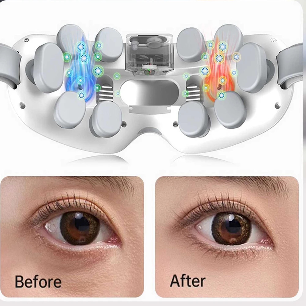 Eye Massager for Migraines Vibrating Cold Mist Eye Acupoint Massage Mask Relieve Stress Eye Care Device for Improve Sleep 251027