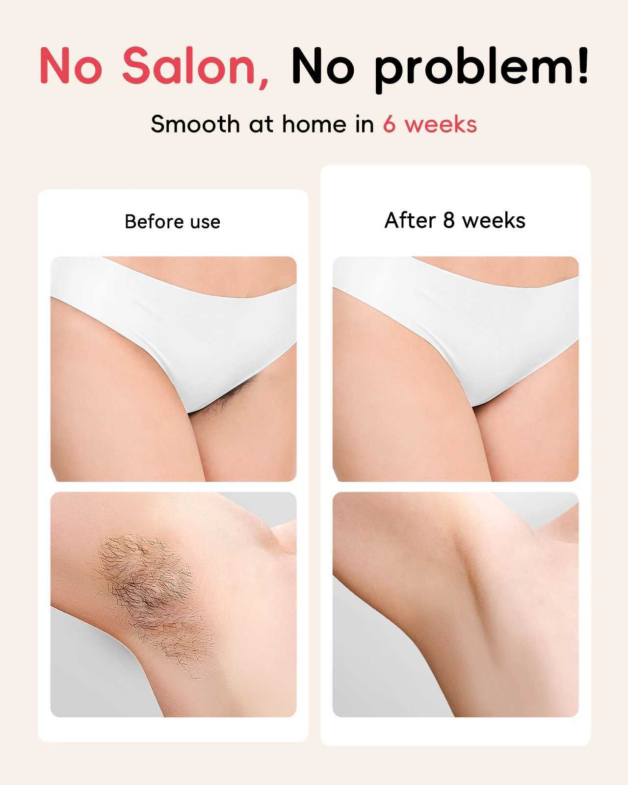 Professional IPL Hair Removal 22J Unlimted Flashes Painless Laser Epilator Armpits Legs Arms Bikini Line Treament Home Use J251117