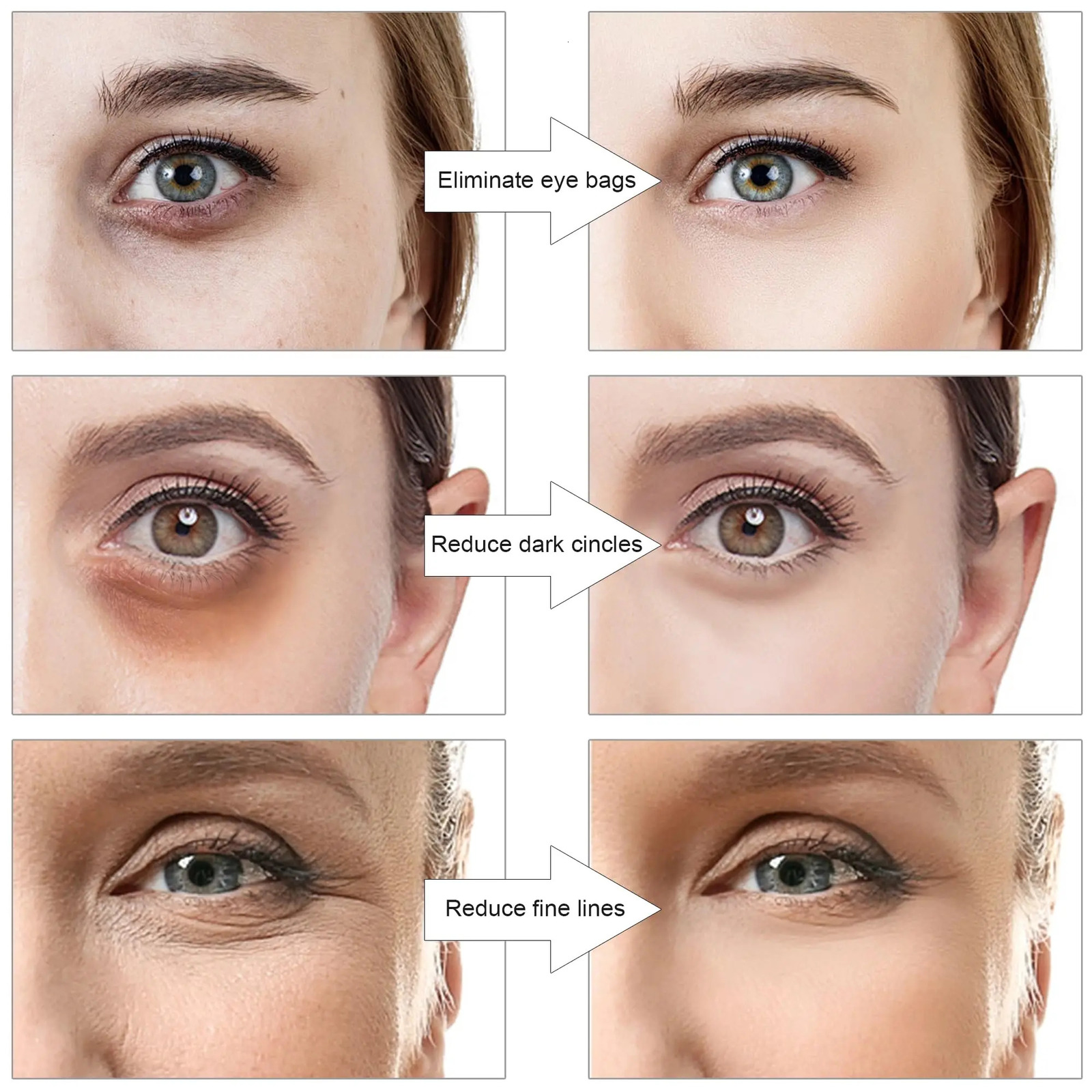 3D Eye Massager Under Eyes Red Light Therapy 251027