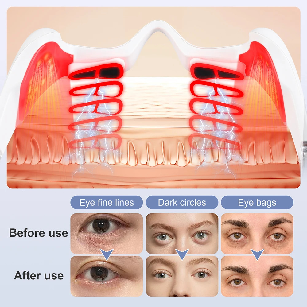 Electric Eye Massager UnderEye Glasses Massager Eye Fatigue Relief Massager Red Light Relieves Eye Fatigue Eyes Massage Glasses 251027