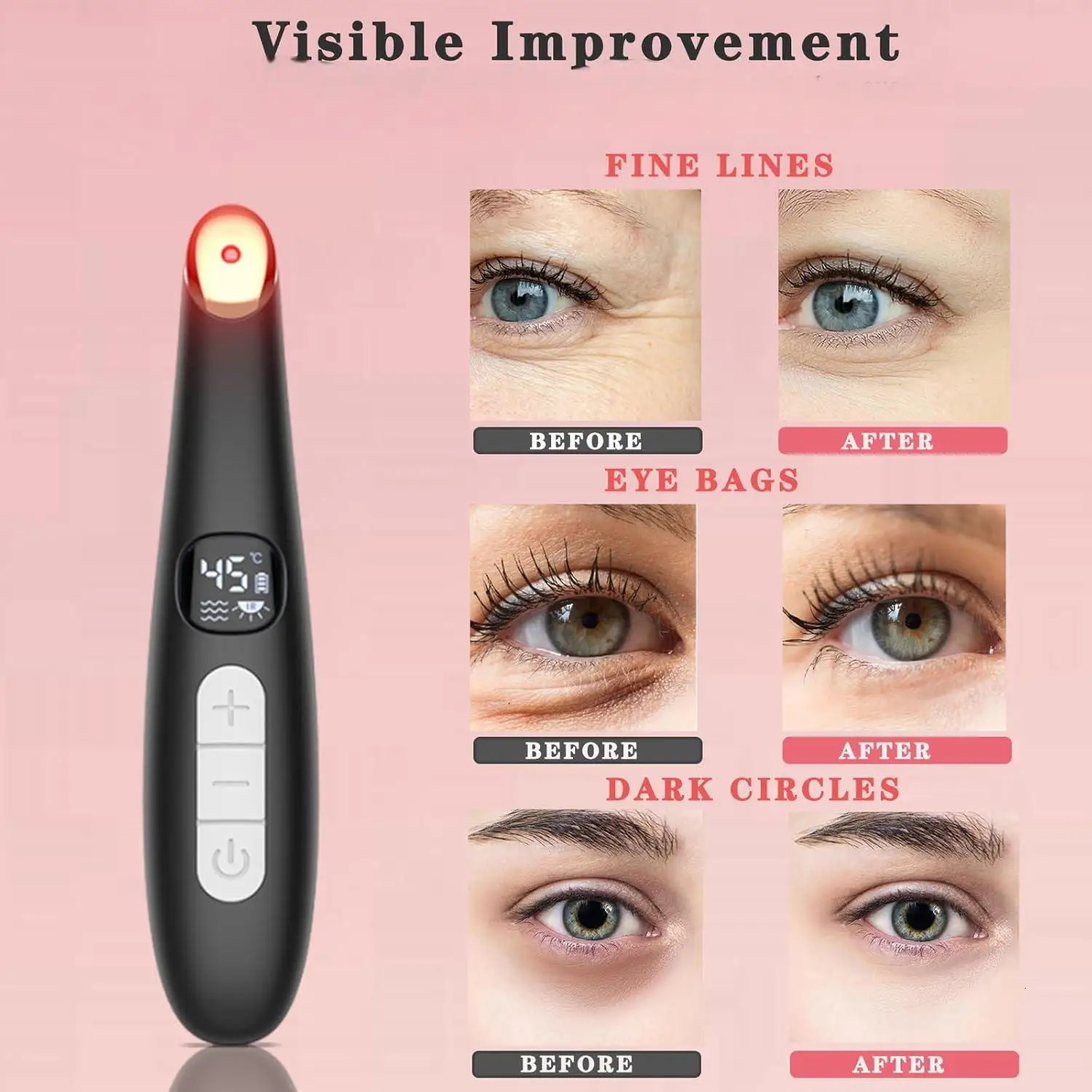 3 in 1 Eye Lift Wand Beauty Device Vibrating Red Light 98F to 113F LCD Display Eye Massager for Dry Eye Dark Circle Puffiness 251027