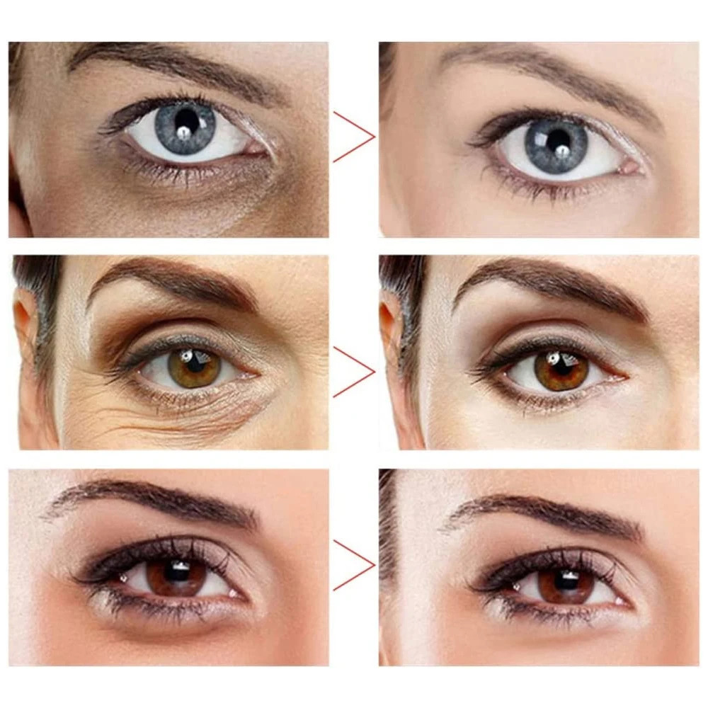 Sleep Eye Massager Mask Spoon DIY Dark Circles Eye Cream Scooping Massage Stick Beauty ToolAntiAging Soothing Eye Fatigue 251027