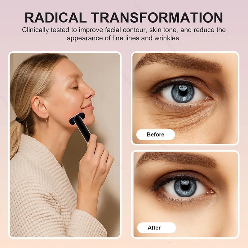 7 Color Light Beauty Wand Compress Red Light Therapy For Face Neck EMS Microcurrent Facial Device Vibration Eye Massager 251027