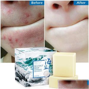 Savon fait à la main 100G Enlèvement Pimple Pores Traitement de l'acné Savon au sel de mer Nettoyant Lait de chèvre Hydratant Soin du visage Base de lavage pour la chute de la peau Dhehq