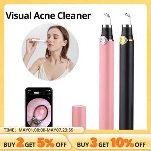 Home Beauty Instrument Intelligent Visual Acné aiguille avec 20x caméra Blackhead Cleaning Beauty Tool Extraction faciale Q240507