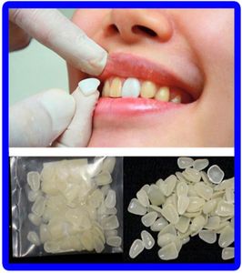 Otra higiene bucal 70 unids / lote Corona temporal dental ultra delgada Resina ultra delgada Blanqueamiento de dientes Sombra anterior superior Carillas dentales 4166357