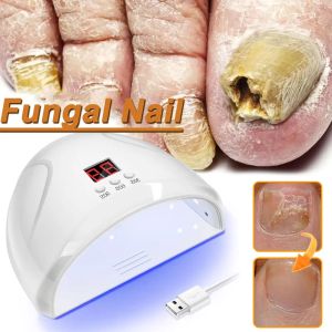Herramienta de uñas Fungal Dispositivo de láser Toe Fungo de uñas Reprozamiento Fungus de uña Fungo de uña