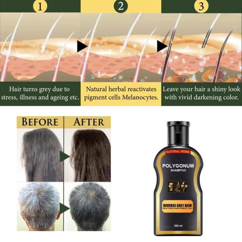 New Polygonum Reverse Hair Color Shampoo Promote Hair Growth Anti-Dandruff Moisturize And Repair Damaged Hair New Polygonum Reverse Hair Color Shampoo Promote Hair Growth Anti-Dandruff Moisturize And Repair Damaged Hair