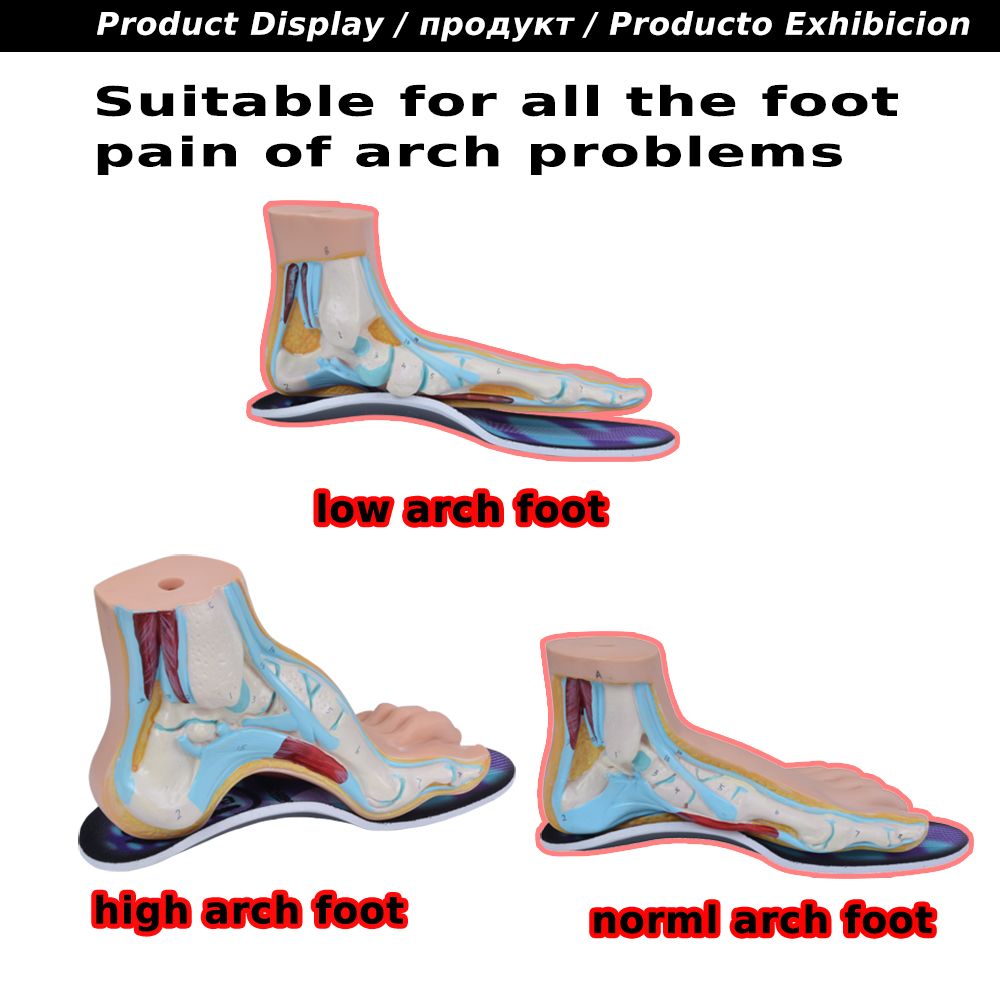 high arch foot insoles