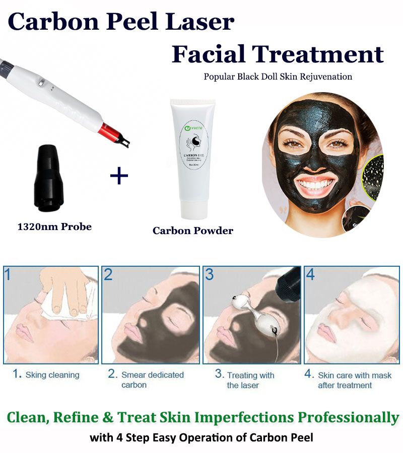 Carbon Peel Machine