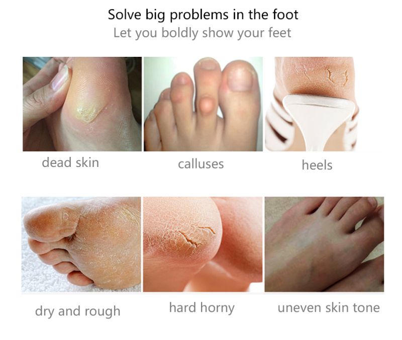Efero Pc Pair Feet Exfoliating Foot Mask Peeling Dead Skin Feet Mask Pedicure Socks Foot Cream Remove Dry Skin Moisture Tslm From Yiqinmy 18 04 Dhgate Com