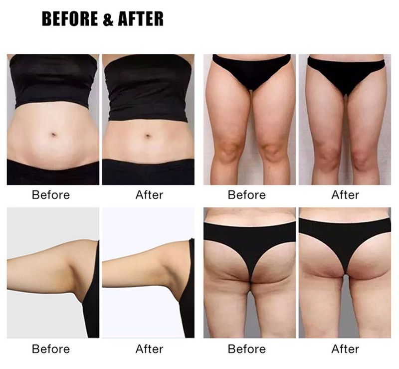 Backpage Nova Bodyrub