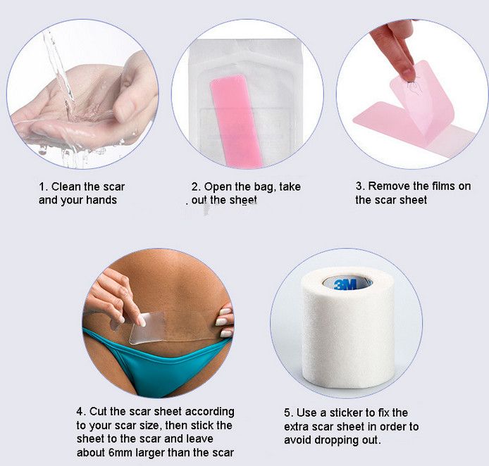 where to buy silicone gel sheets for scars