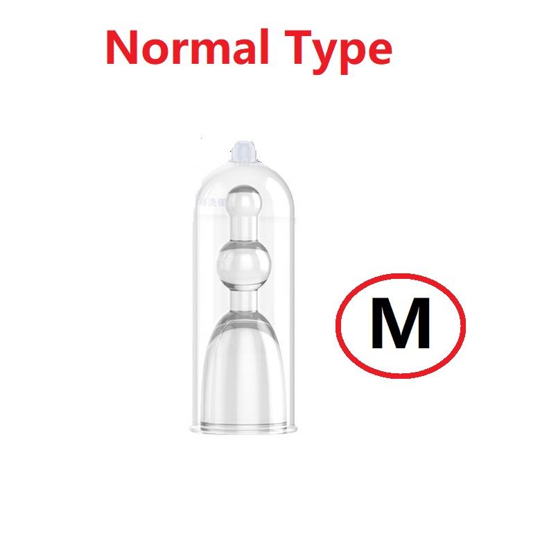 Normaal type: m