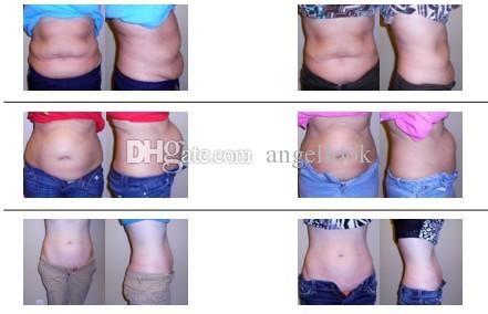 2020 Professional Dual Diode Laser Lipo 650nm Lipolaser Beauty Equipment Strawberry Laser Lipo Slimming Machine Weight Loss Salon Equipment From Yufjfb 127 67 Dhgate Com