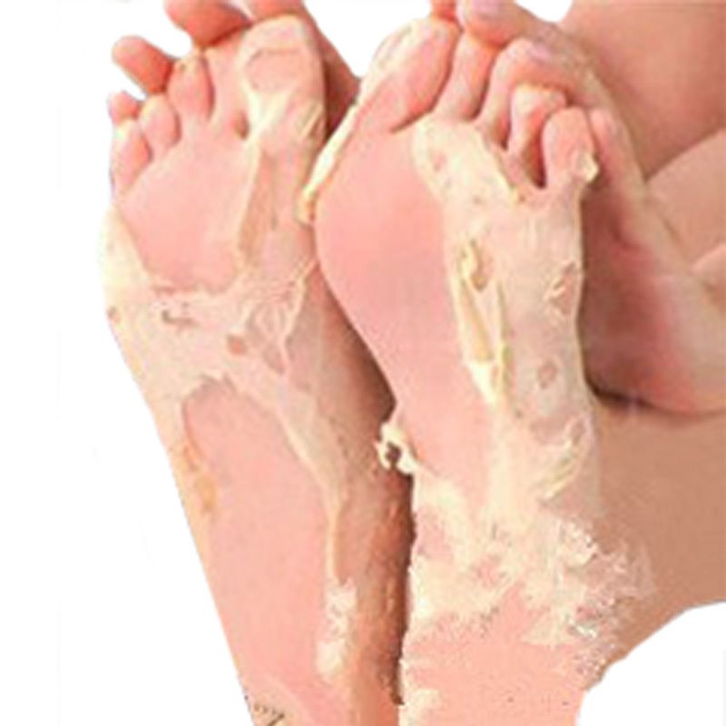 after foot peel care