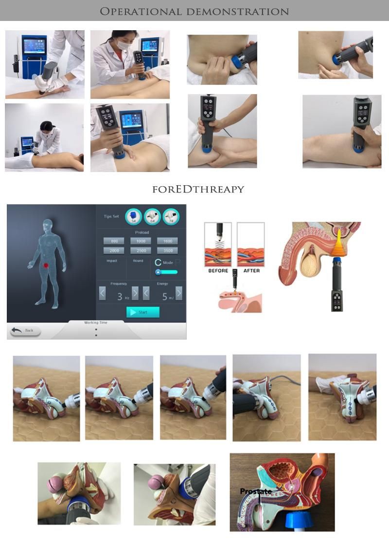 Low Intensity Shockwave Therapy With 2 Handles Acoustic Wave For Erectile Dysfunction ED Pain