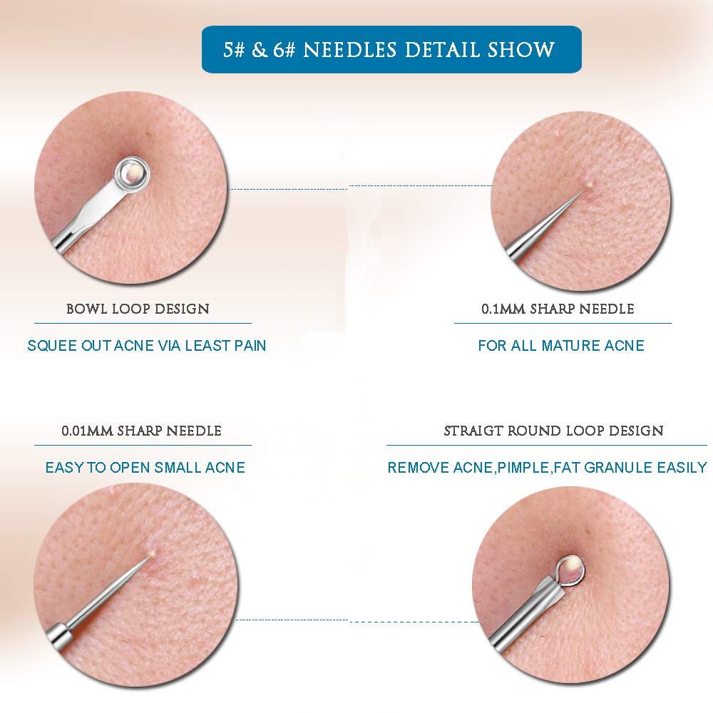 professional blackhead removal