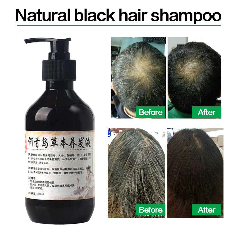 Herbal Natural Polygonum Multiflorum Shampoo Plant Liquid Grey Hair White Hair Removal Turn Permanent Black Hair Herbal Natural Polygonum Multiflorum Shampoo Plant Liquid Grey Hair White Hair Removal Turn Permanent Black Hair