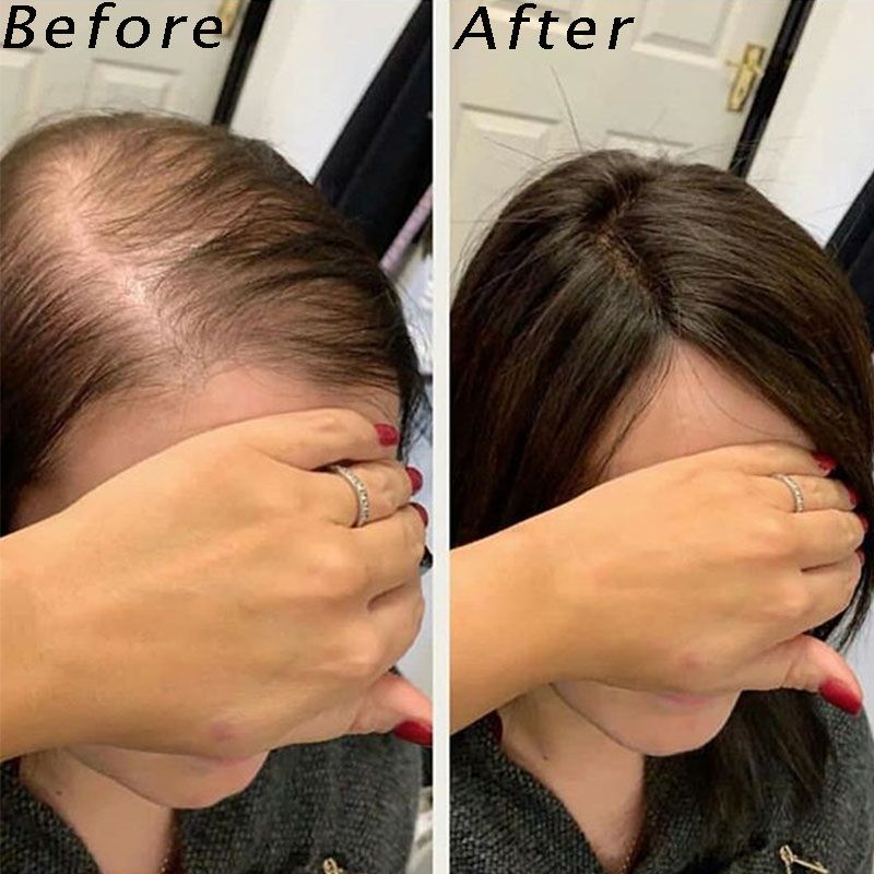 best hair toppers for women