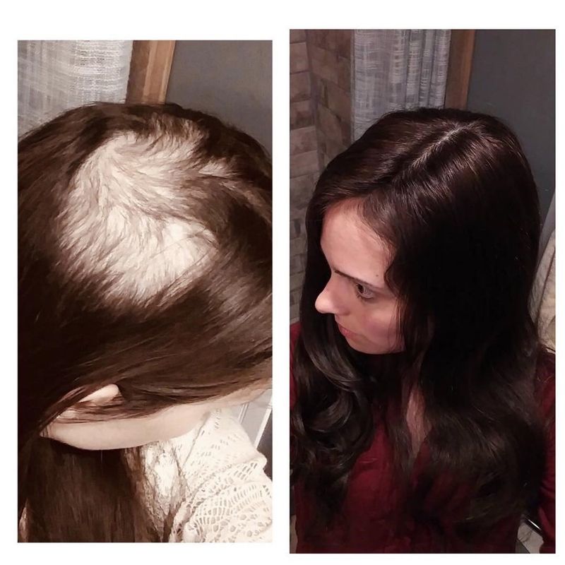 best human hair topper