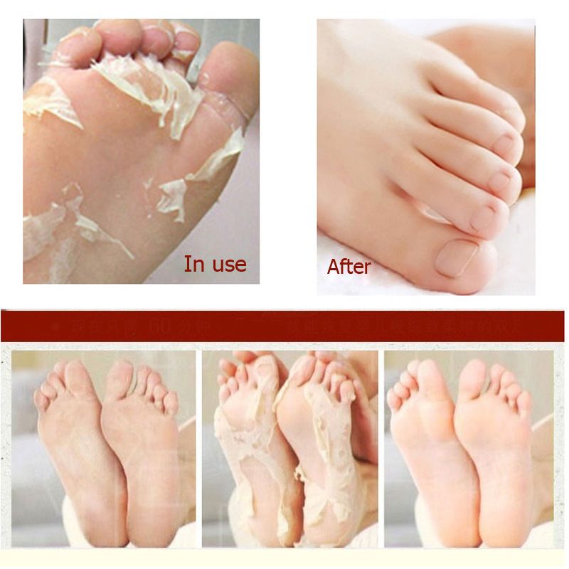 life Supple Compress 2 Pièces Par Paire Baby Foot Peeling Renouvellement Pied Masque Supprimer Mort Peau Lisse Exfoliant Pieds Chaussettes Soins Pour Pédicure Pied Produit De Traitement Du 1,34 € | DHgate life Supple Compress 2 Pièces Par Paire Baby Foot Peeling Renouvellement Pied Masque Supprimer Mort Peau Lisse Exfoliant Pieds Chaussettes Soins Pour Pédicure Pied Produit De Traitement Du 1,34 € | DHgate