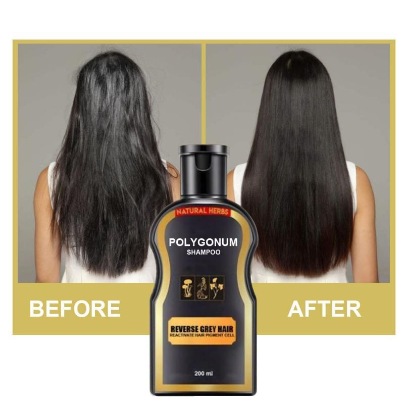 gray hair treatment