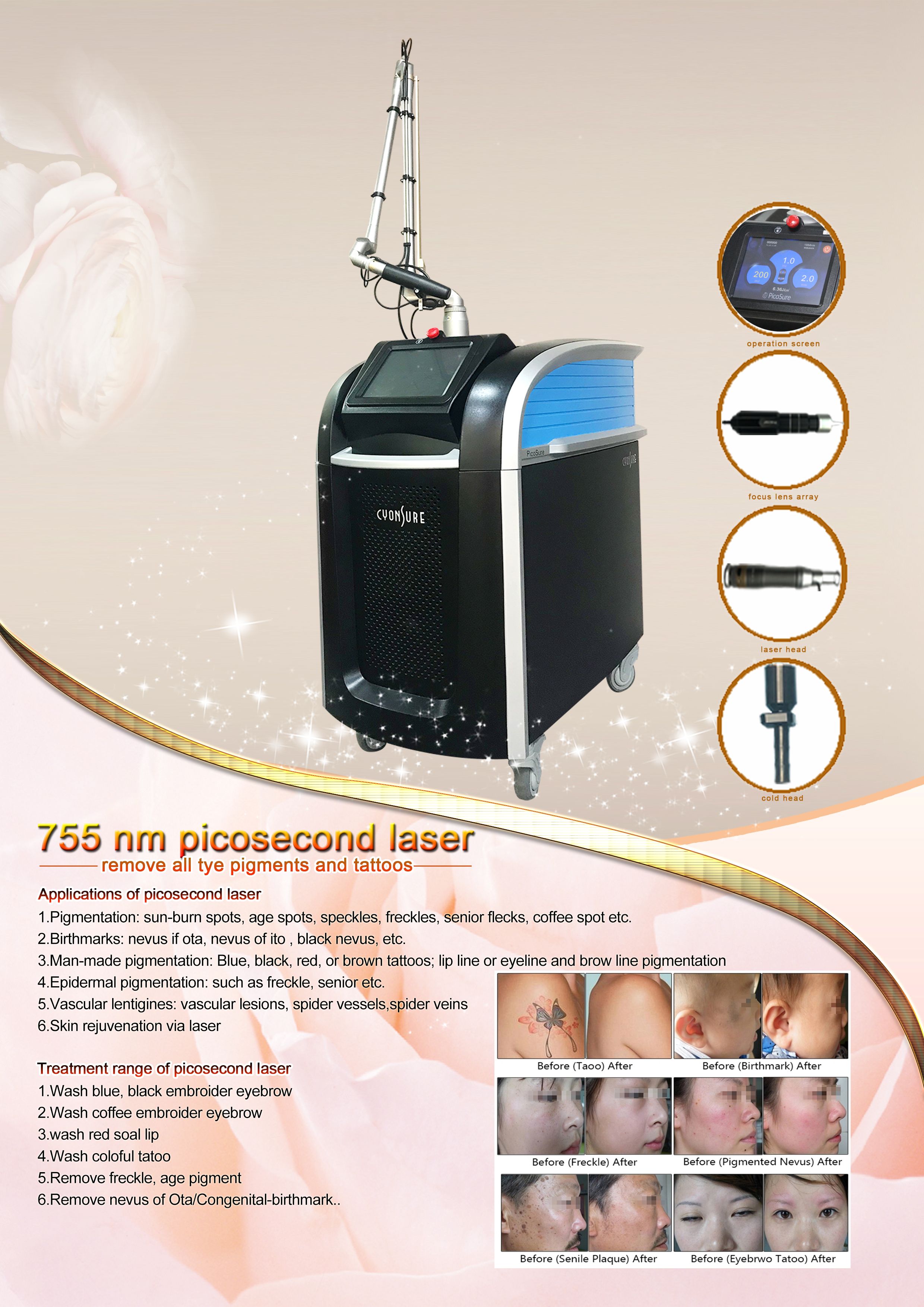 Laser Picosure For Tattoo Removal Q Switch Pico Laser 1064nm 532nm 755nm Picosecond Tattoo