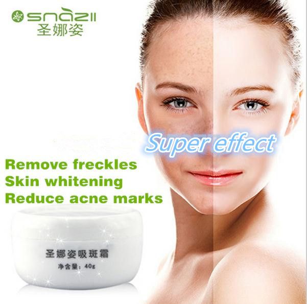 2018 Snazii Remove Freckles Face Cream Dark Spot Remover 