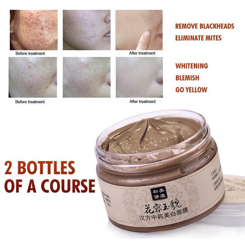 Freckle Face Mask Cream Acne Scars Remove Blackhead Mite Treatment