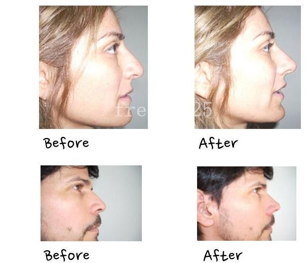 2018 wholesale secret nose up one minute nose up 2018 wholesale secret nose up one minute nose up