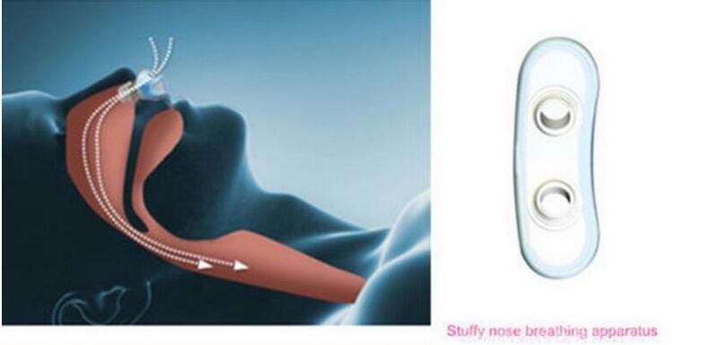 2020 New Nose Reshape Noseup Clip Lifting Shaping Clipper Clamp Shaper