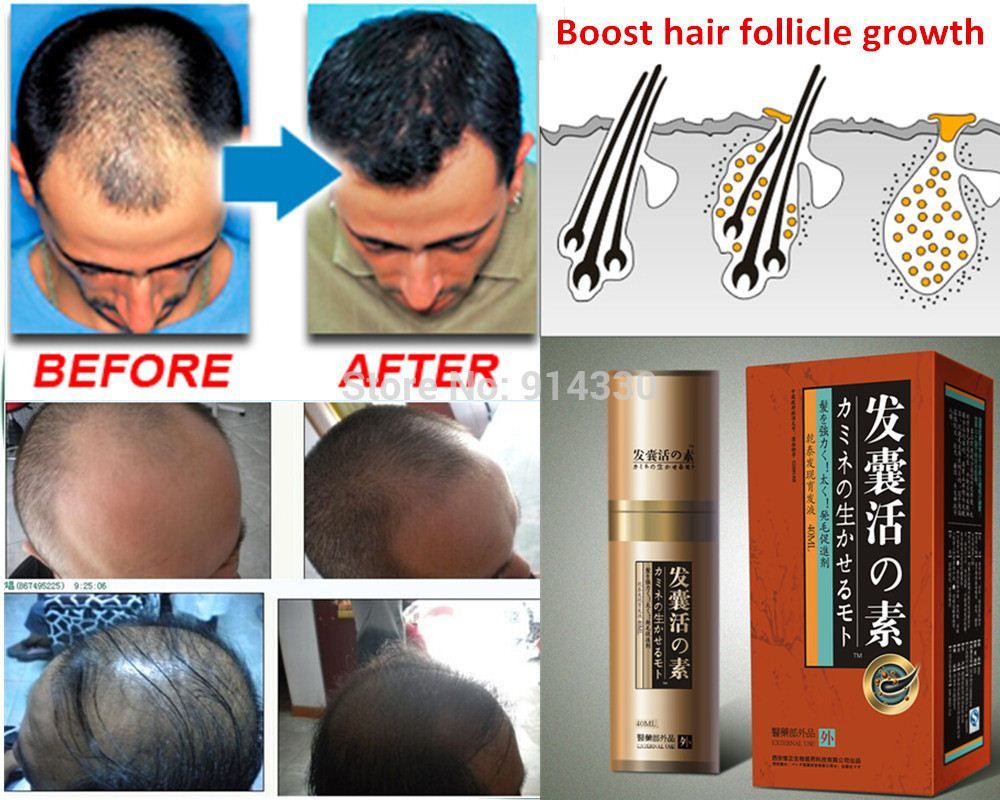 40ml Pack Boost Hair Growth Loss Product Hair Growth Natural