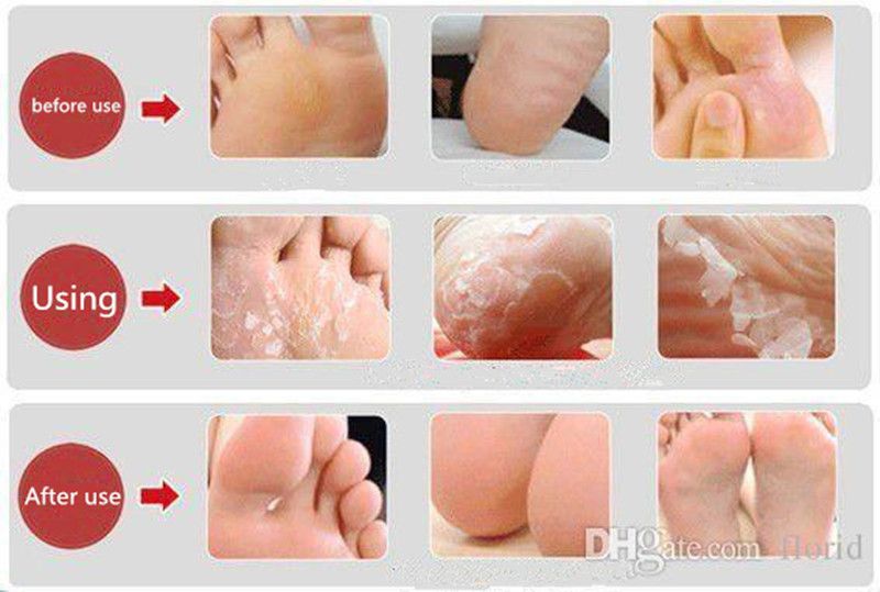 baby feet peel target