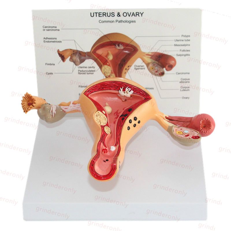 View Adnexal Cyst Meaning In Bengali Background